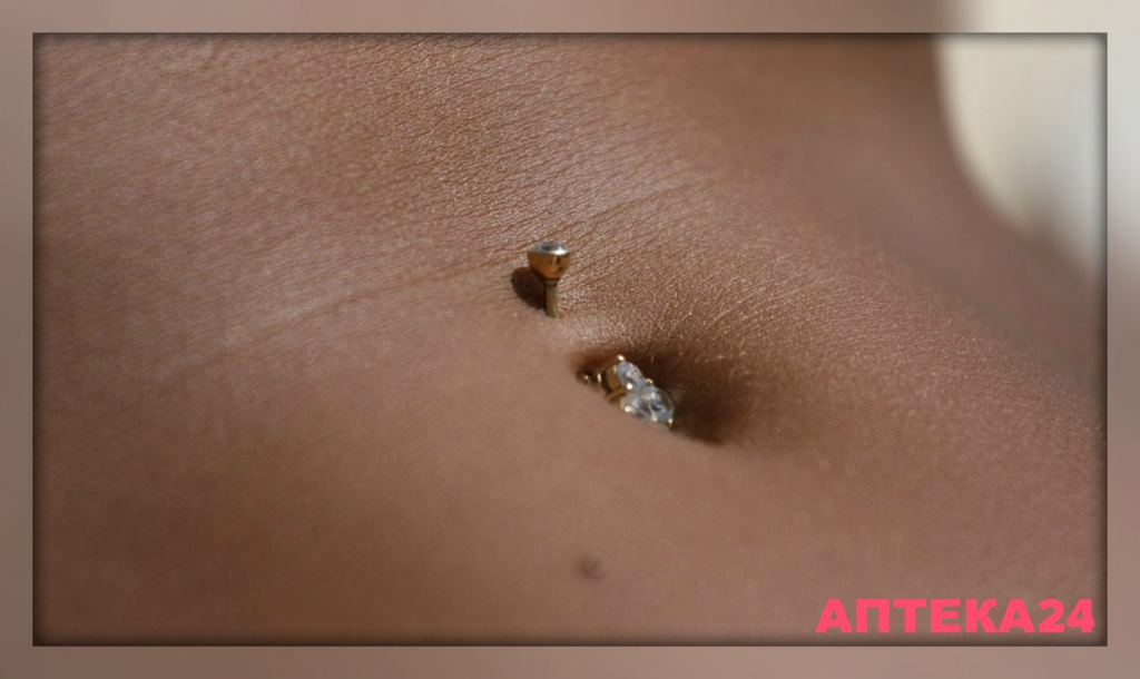 Омфалит у взрослых