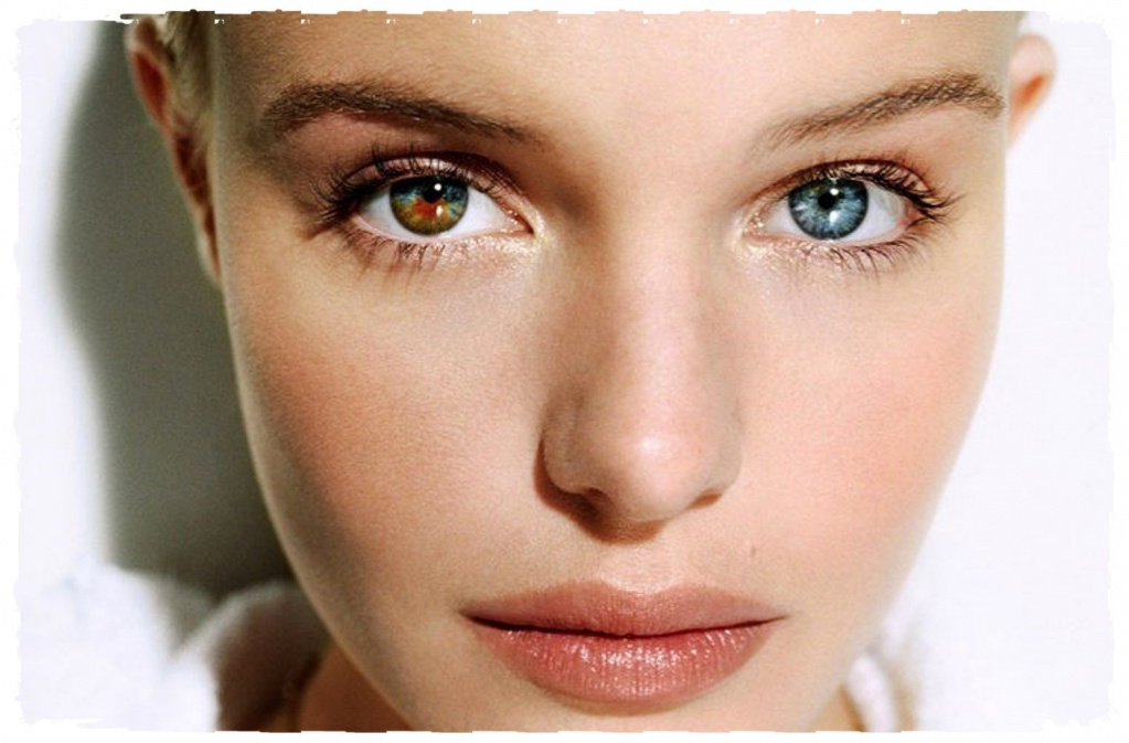 гетерохромия, разный цвет глаз, глаза разного цвета, гетерохромия у людей, виды гетерохромии, причины гетерохромии