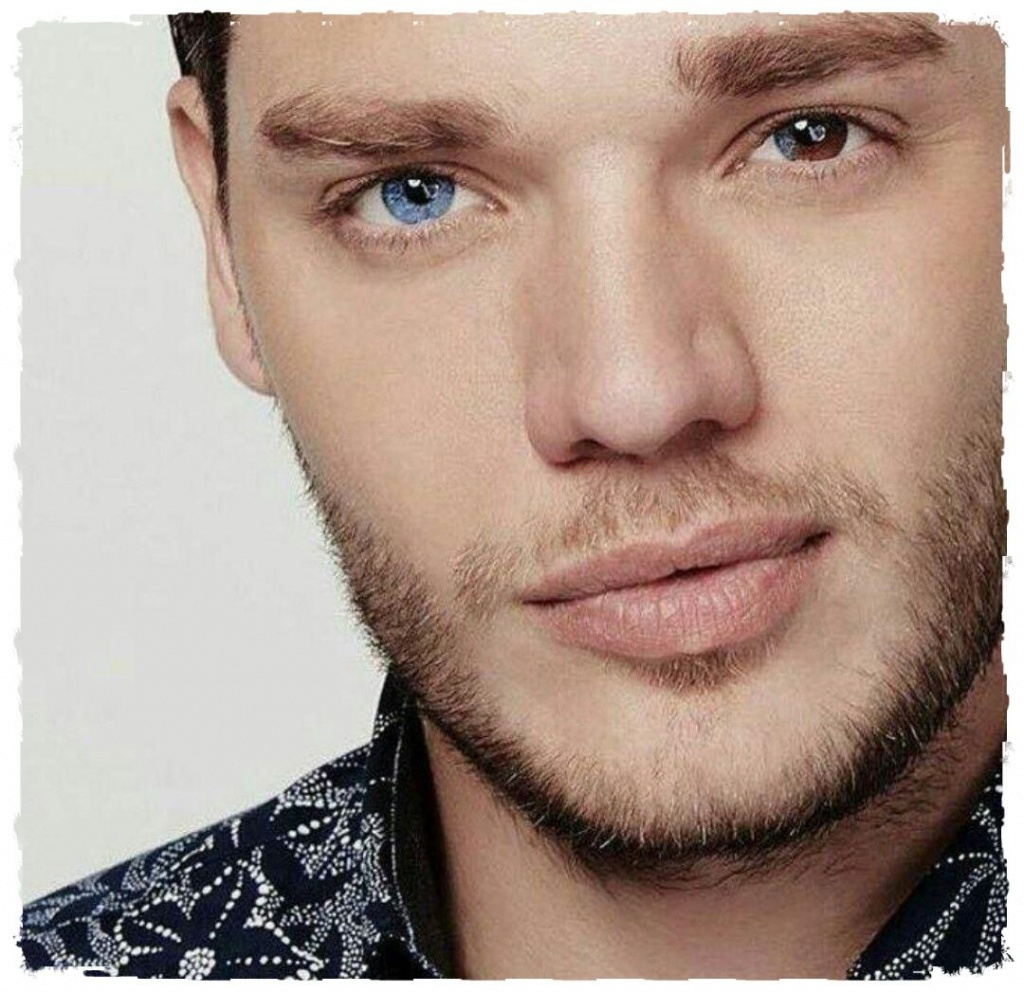 гетерохромия, разный цвет глаз, глаза разного цвета, гетерохромия у людей, виды гетерохромии, причины гетерохромии