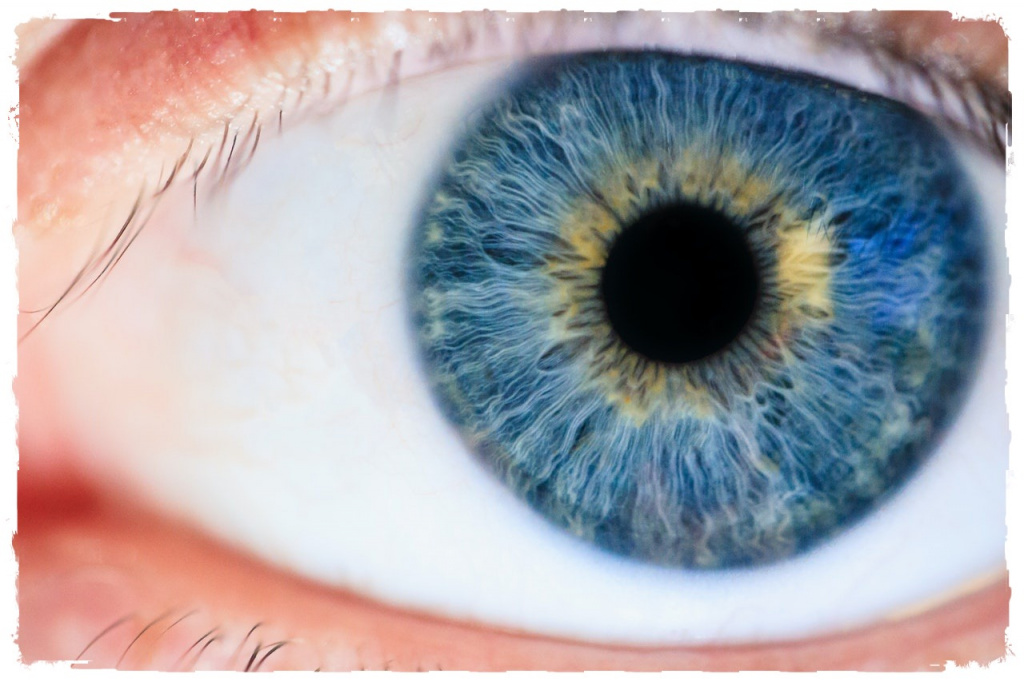 гетерохромия, разный цвет глаз, глаза разного цвета, гетерохромия у людей, виды гетерохромии, причины гетерохромии