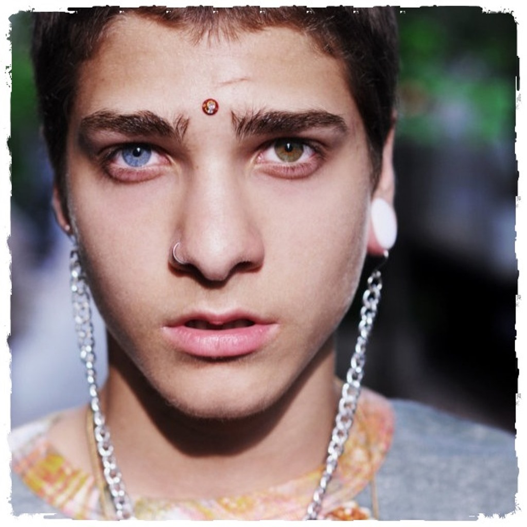 гетерохромия, разный цвет глаз, глаза разного цвета, гетерохромия у людей, виды гетерохромии, причины гетерохромии